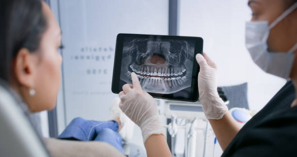 Licensed Teeth Whitening service in Boyce, LA - Smile Center Dentistry